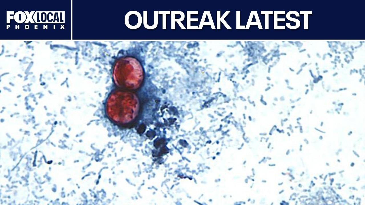 Cyclospora outbreak reaches 45 states