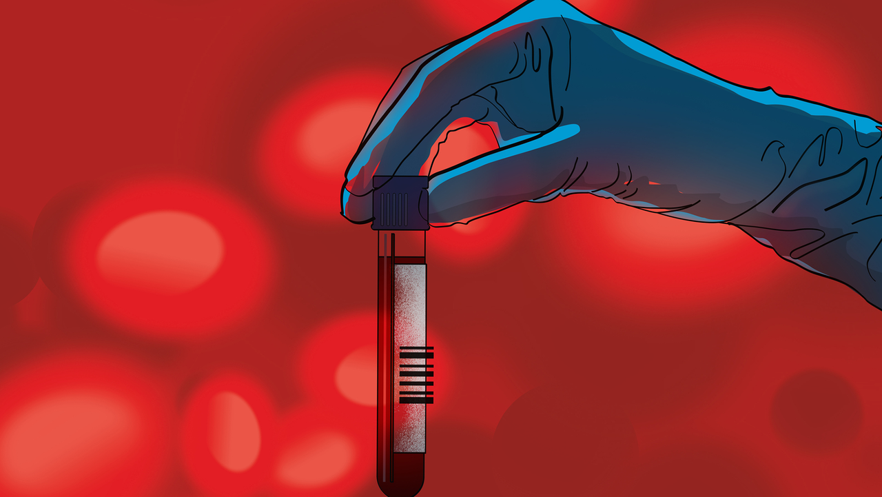 Alzheimer's blood tests are transforming how patients get diagnosed — here's what to know