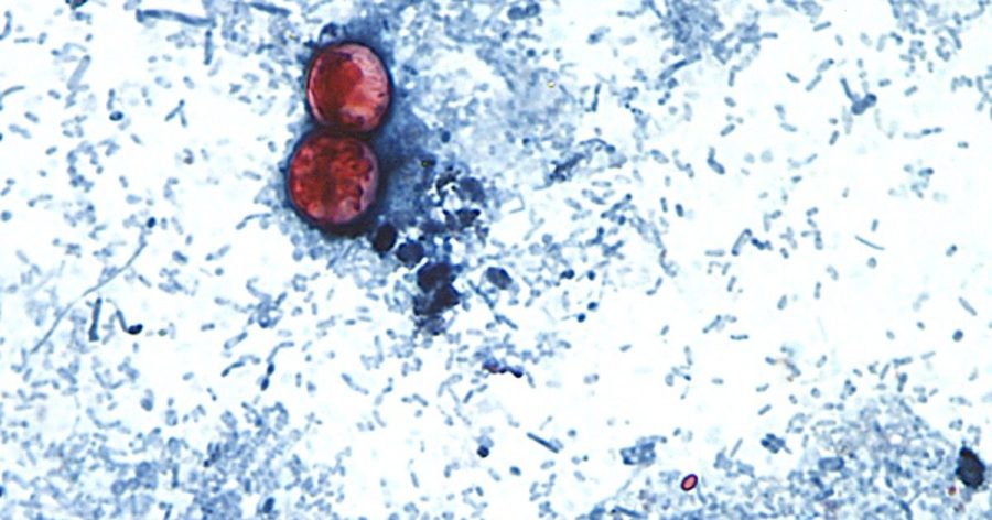 Doctor warns against 'cyclospora skinny' trend