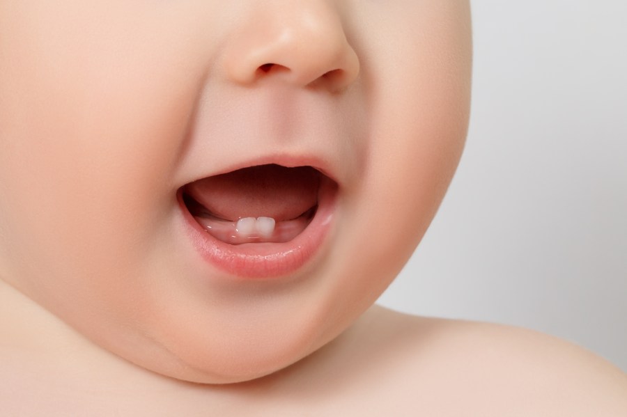 Why do Ohio researchers want your baby teeth?