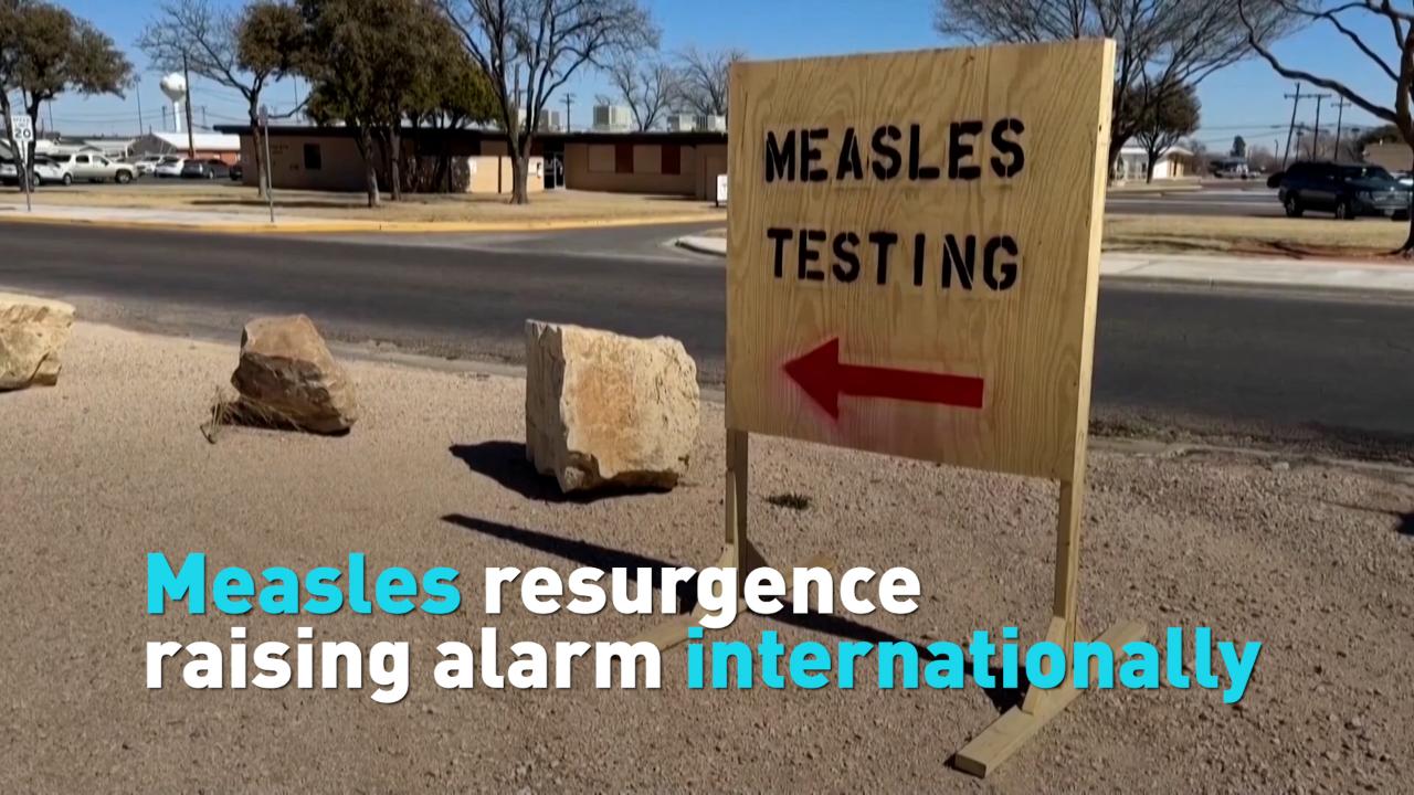 Measles resurgence raising alarm internationally