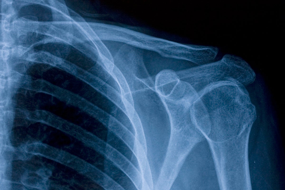 How sleep and your internal body clock help keep your bones strong