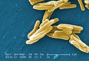 SC health officials tracing tuberculosis exposure at Summerville High School. Here’s what we know.