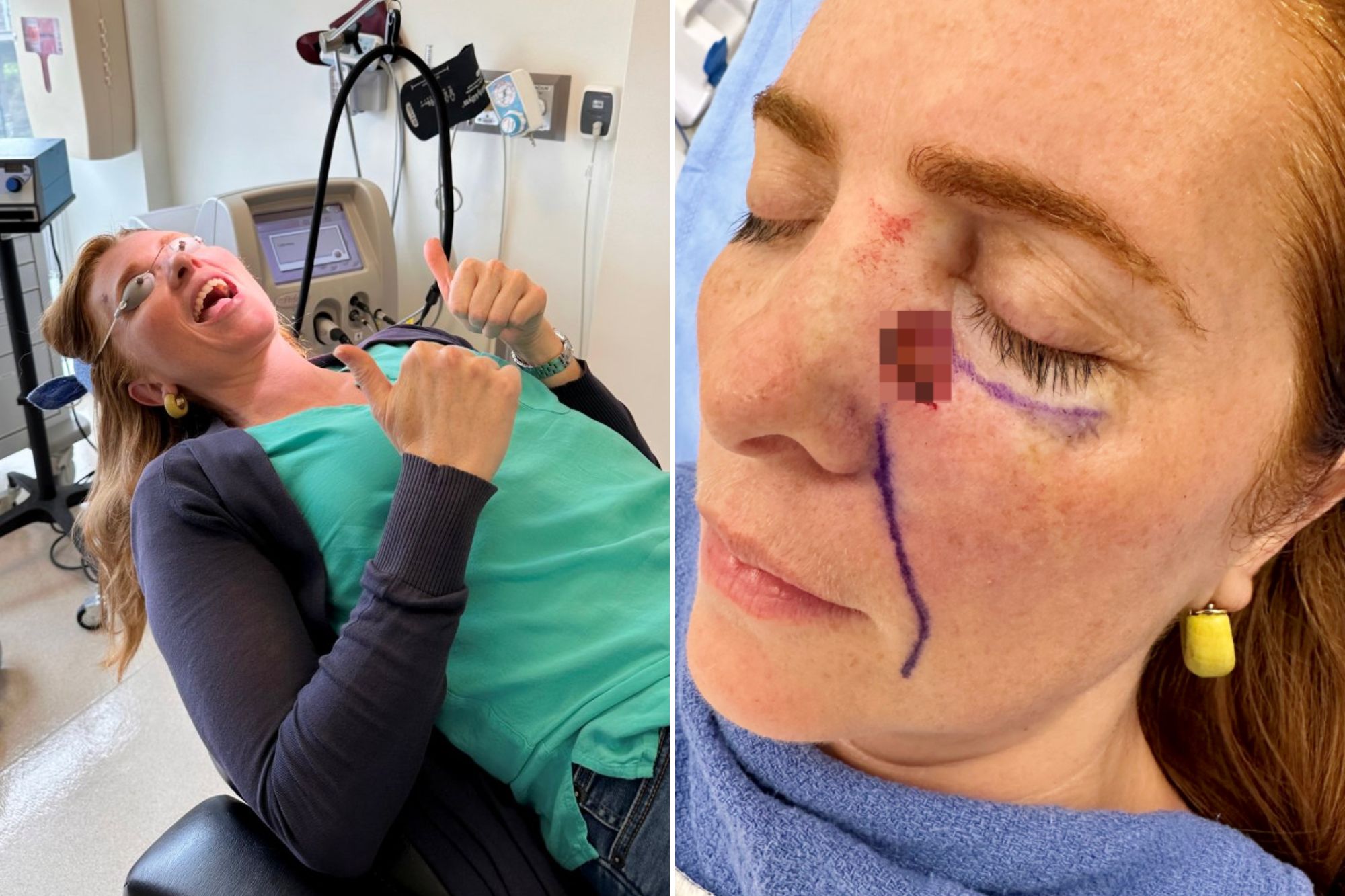 Influencer left with 60 face stitches after sunbed habit led to skin cancer