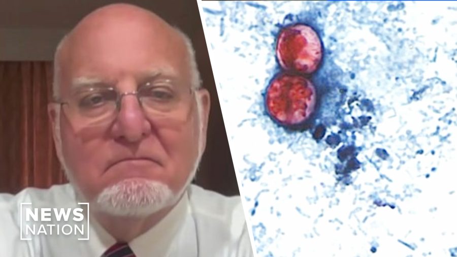 Cyclospora has expanded to fruit, other vegetables: Ex-CDC director