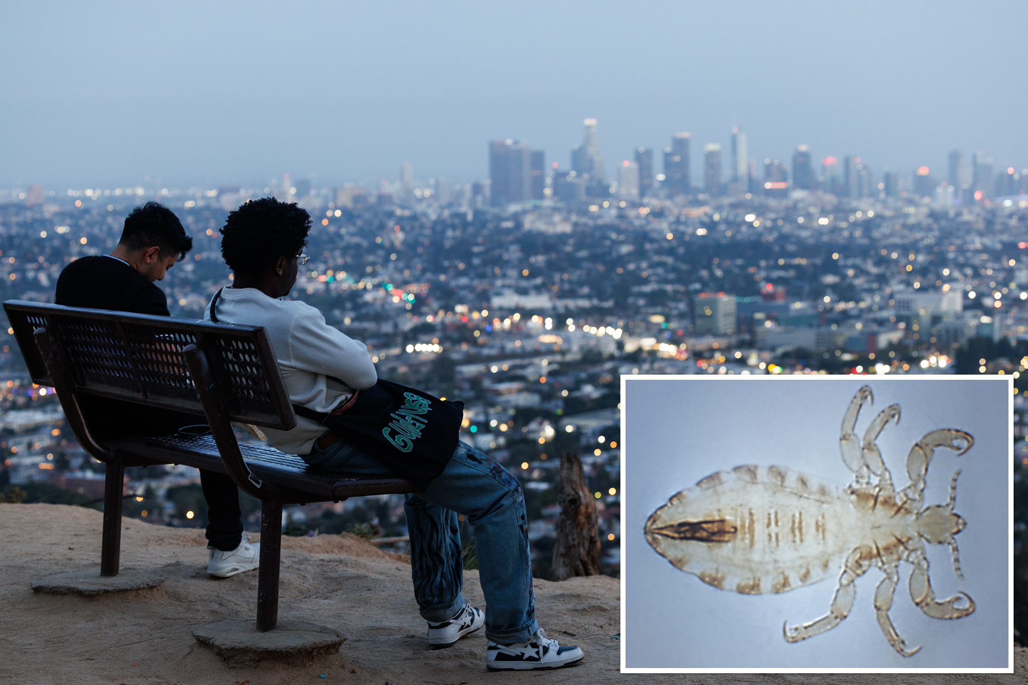 After typhus in LA, what’s next — bubonic plague?
