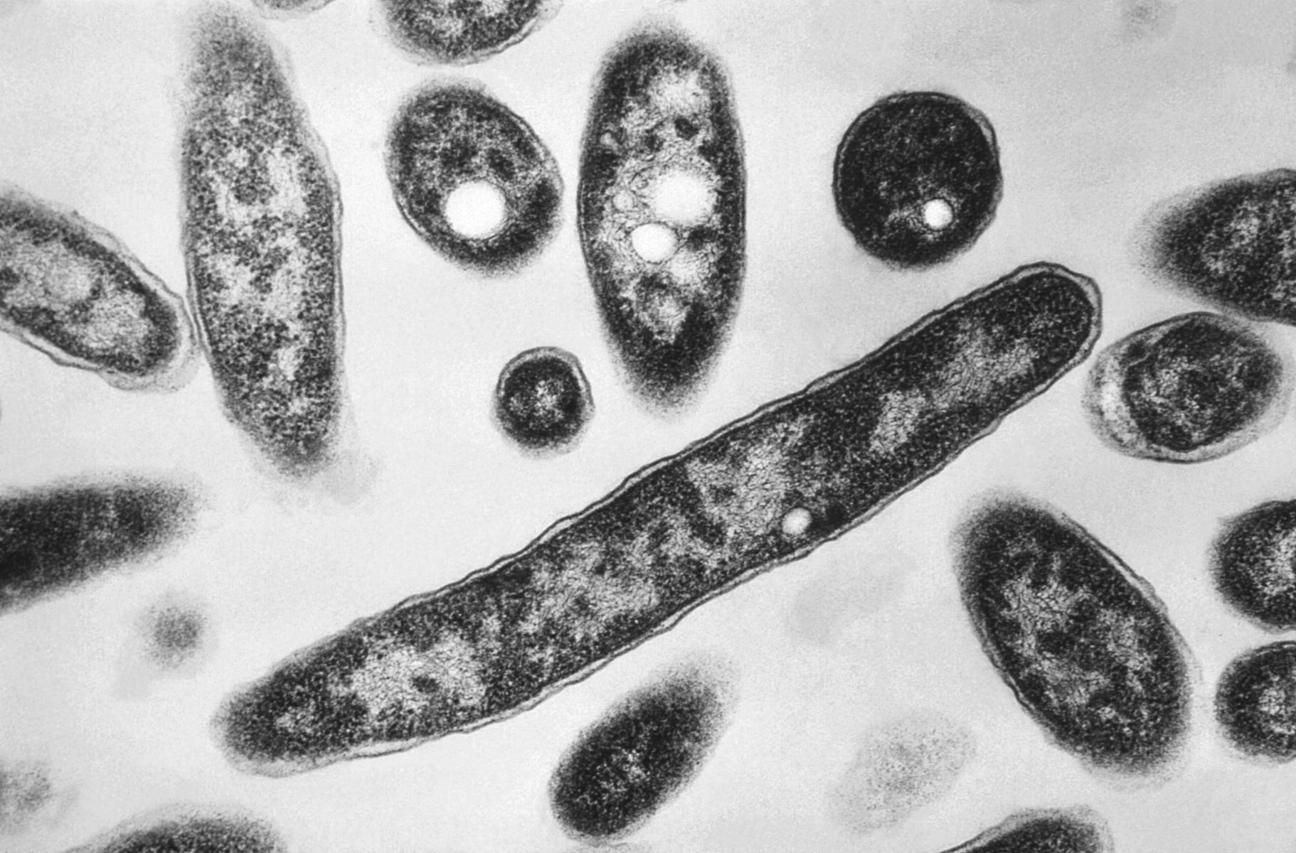 Bacteria that causes Legionnaires’ disease found in Pa. county jail