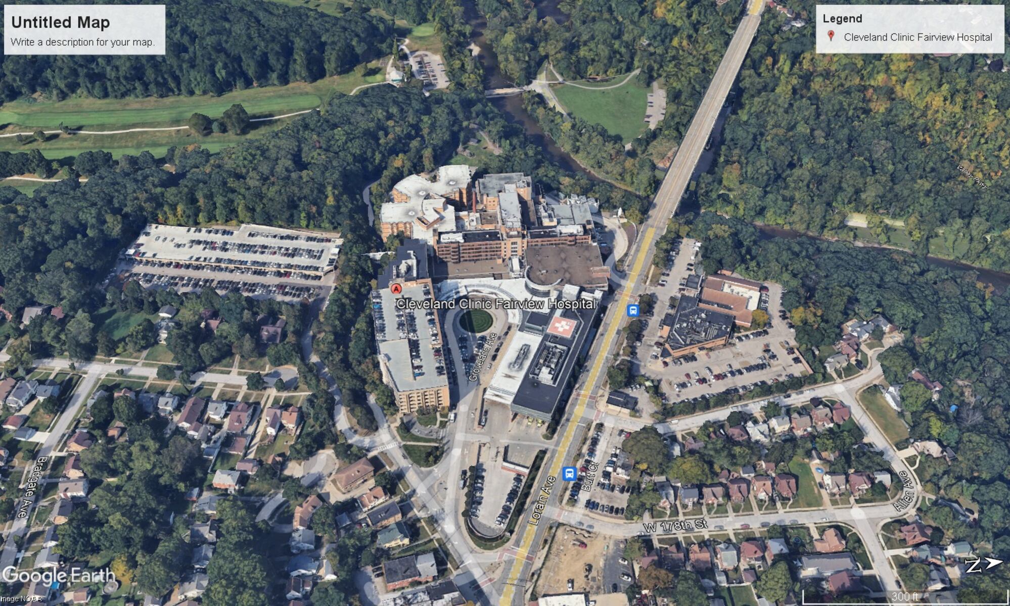 Cleveland Planning Commission approves Fairview Hospital pedestrian bridge