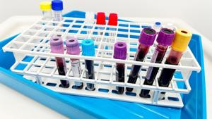 A single US measles outbreak can cost millions of dollars, study estimates