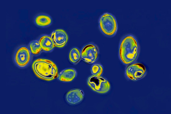 CDC: 13 cases of new fungus in WA