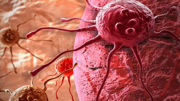 Russian & Iranian Scientists Use 'Laser Sword' to Combat Cancer