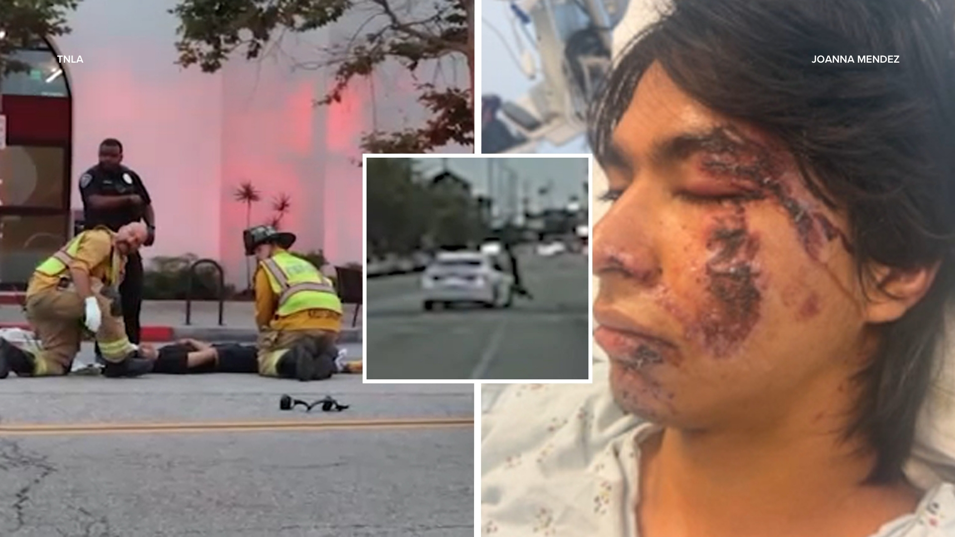 Culver City pedestrian describes being hit by driver fleeing police in 'violent rampage'