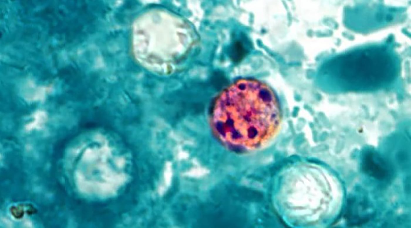 Voices: What Utahns need to know about cyclospora