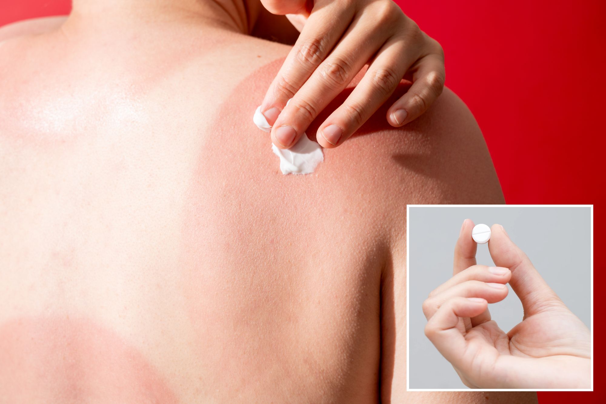 Urgent warning over common painkiller that risks blistering sunburn in hot weather – the 3 rules to follow