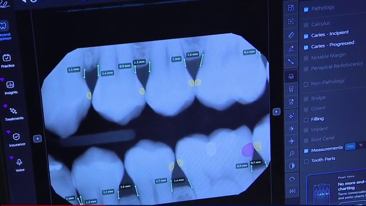 How AI in dentistry is transforming smiles