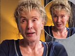 Beverley Callard, 69, says she was told 'worst was yet to come' as she issues a health update after completing radiotherapy treatment amid breast cancer battle