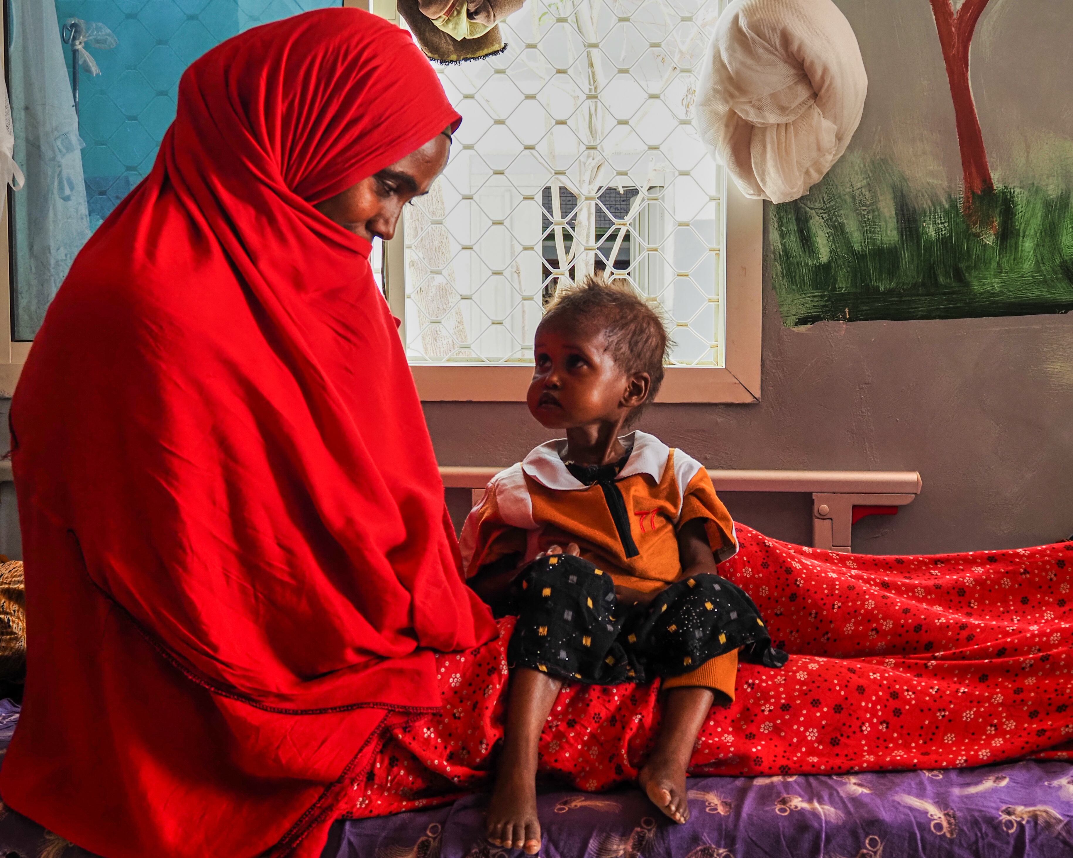 Severe malnutrition in Somalia is surging after U.S. cuts, aid groups say