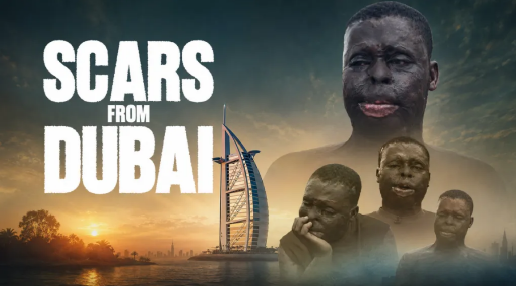 Scars From Dubai: 28-year-old fights to rebuild his life after acid attack disfigured him