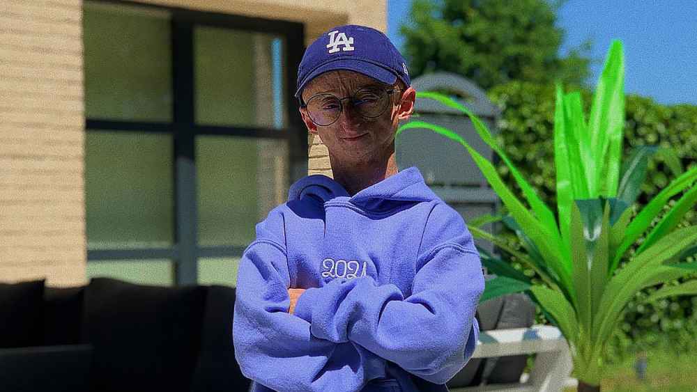 Influencer Michiel Vandeweert With Rare Genetic Disorder Dies at Age 28