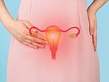 Doctors discover intriguing op can cut risk of 'hidden killer' ovarian cancer risk by 80%
