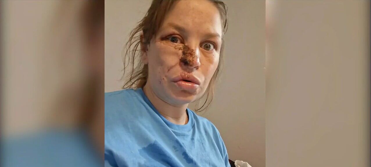 Pregnant woman brutally attacked by dogs blames owner: ‘You almost cost three lives’