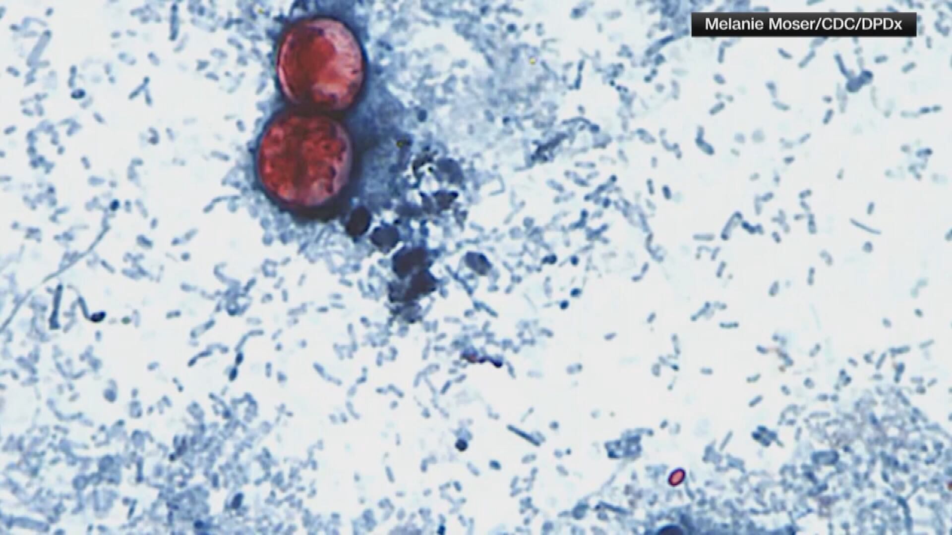 Missouri reports third-most cyclospora cases in nation as outbreak slows