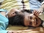 Conjoined twin girls, 2, die on operating table after fifth desperate surgery to separate them goes wrong